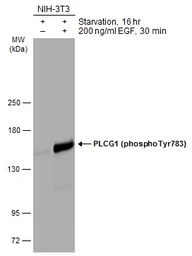 Anti-PLCG1 (phospho Tyr783) antibody used in Western Blot (WB). GTX133465