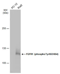 Anti-FGFR1 (phospho Tyr653/654) antibody used in Western Blot (WB). GTX133526