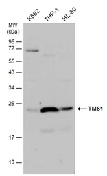 Anti-TMS1 antibody used in Western Blot (WB). GTX133582