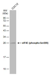 Anti-eIF4E (phospho Ser209) antibody used in Western Blot (WB). GTX133606