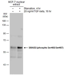 Anti-SMAD2 (phospho Ser465/Ser467) antibody used in Western Blot (WB). GTX133614