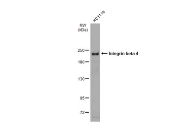Anti-Integrin beta 4 antibody used in Western Blot (WB). GTX133651