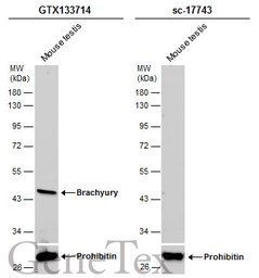 Anti-Brachyury antibody used in Western Blot (WB). GTX133714