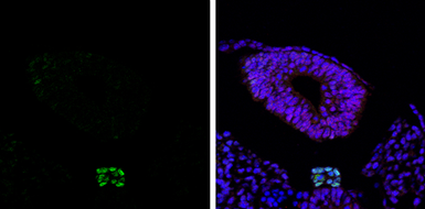 Anti-Brachyury antibody used in IHC (Paraffin sections) (IHC-P). GTX133714