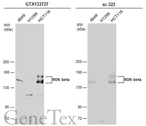 Anti-RON beta antibody used in Western Blot (WB). GTX133727