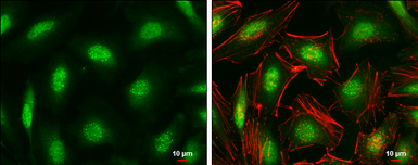 Anti-ID1 antibody used in Immunocytochemistry/ Immunofluorescence (ICC/IF). GTX133738