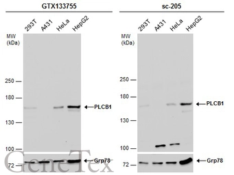 Anti-PLCB1 antibody used in Western Blot (WB). GTX133755