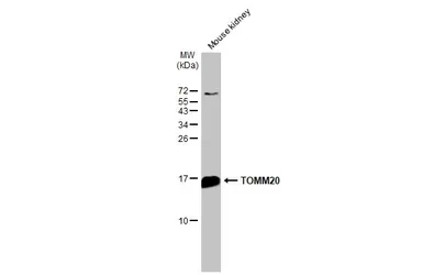 Anti-TOMM20 antibody used in Western Blot (WB). GTX133756