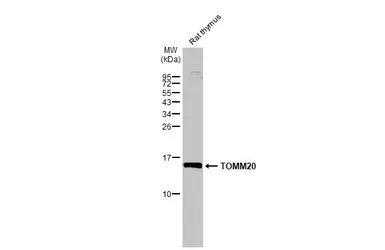Anti-TOMM20 antibody used in Western Blot (WB). GTX133756