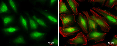 Anti-SKP2 antibody used in Immunocytochemistry/ Immunofluorescence (ICC/IF). GTX133767