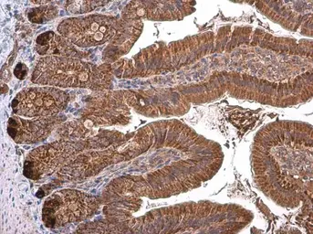 Anti-TOMM40 antibody used in IHC (Paraffin sections) (IHC-P). GTX133780