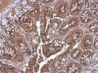 Anti-TOMM40 antibody used in IHC (Paraffin sections) (IHC-P). GTX133780