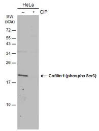 Anti-Cofilin 1 (phospho Ser3) antibody used in Western Blot (WB). GTX133865