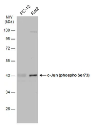 Anti-c-Jun (phospho Ser73) antibody used in Western Blot (WB). GTX133873