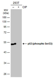 Anti-p53 (phospho Ser33) antibody used in Western Blot (WB). GTX133902