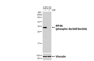 Anti-RPS6 (phospho Ser240/Ser244) antibody used in Western Blot (WB). GTX133942