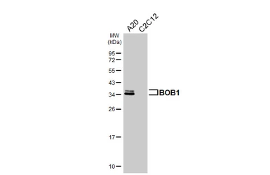 Anti-BOB1 antibody used in Western Blot (WB). GTX133968