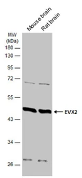 Anti-EVX2 antibody used in Western Blot (WB). GTX134003