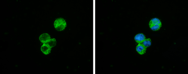 Anti-C1qA antibody used in Immunocytochemistry/ Immunofluorescence (ICC/IF). GTX134007