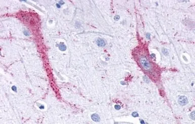 Anti-TA3 antibody used in IHC (Paraffin sections) (IHC-P). GTX13402