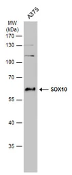 Anti-SOX10 antibody used in Western Blot (WB). GTX134106