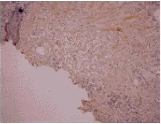 Anti-Osteocalcin antibody [OC4-30] used in IHC (Paraffin sections) (IHC-P). GTX13418