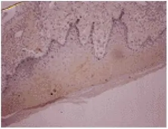 Anti-Osteocalcin antibody [OC4-30] used in IHC (Paraffin sections) (IHC-P). GTX13418