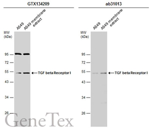 Anti-TGF beta Receptor I antibody used in Western Blot (WB). GTX134209
