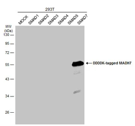 Anti-SMAD7 antibody used in Western Blot (WB). GTX134232