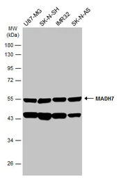 Anti-SMAD7 antibody used in Western Blot (WB). GTX134232