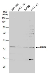 Anti-MEK1 antibody used in Western Blot (WB). GTX134234
