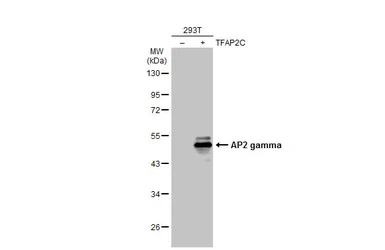 Anti-AP2 gamma antibody used in Western Blot (WB). GTX134259