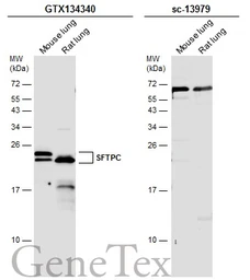 Anti-SFTPC antibody used in Western Blot (WB). GTX134340