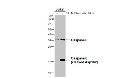Anti-Caspase 6 antibody used in Western Blot (WB). GTX134362