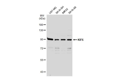 Anti-KIF6 antibody used in Western Blot (WB). GTX134401