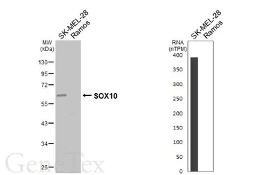 Anti-SOX10 antibody used in Western Blot (WB). GTX134405