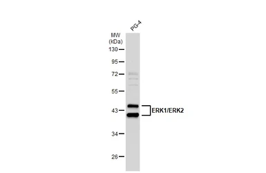 Anti-ERK1/2 antibody used in Western Blot (WB). GTX134462