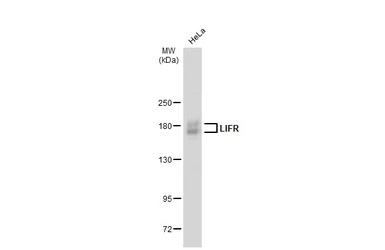 Anti-LIFR antibody used in Western Blot (WB). GTX134466