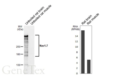 Anti-Nav1.7 antibody used in Western Blot (WB). GTX134494