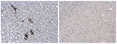 Anti-beta Amyloid (1-42) antibody – Conformation Specific used in IHC (Paraffin sections) (IHC-P). GTX134510