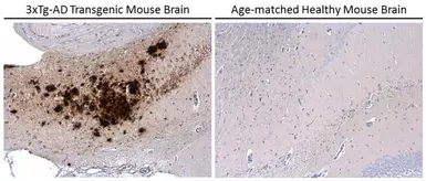 Anti-beta Amyloid (1-42) antibody – Conformation Specific used in IHC (Paraffin sections) (IHC-P). GTX134510