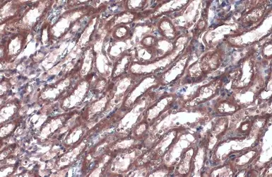 Anti-Caspase 1 p10 subunit antibody used in IHC (Paraffin sections) (IHC-P). GTX134551
