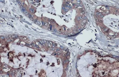 Anti-Thrombospondin 2 antibody used in IHC (Paraffin sections) (IHC-P). GTX134554