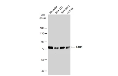 Anti-TAK1 antibody used in Western Blot (WB). GTX134664