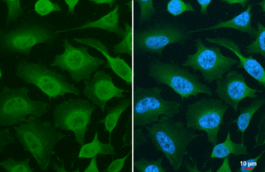 Anti-PDPK1 / PDK1 antibody used in Immunocytochemistry/ Immunofluorescence (ICC/IF). GTX134679
