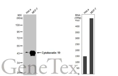Anti-Cytokeratin 19 antibody used in Western Blot (WB). GTX134696