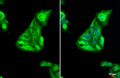 Anti-Cytokeratin 19 antibody used in Immunocytochemistry/ Immunofluorescence (ICC/IF). GTX134696