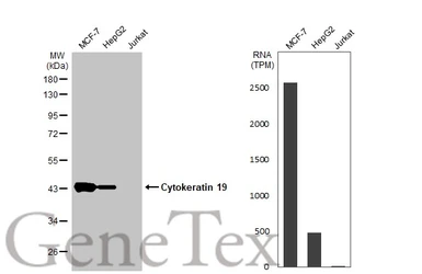 Anti-Cytokeratin 19 antibody used in Western Blot (WB). GTX134696