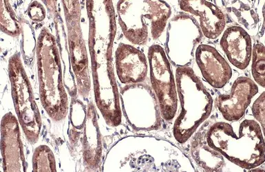 Anti-Cathepsin B antibody used in IHC (Paraffin sections) (IHC-P). GTX134724