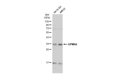 Anti-GPM6A antibody used in Western Blot (WB). GTX134741